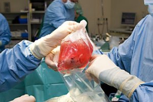 Какое будущее у трансплантологии?