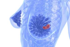 Антиэстрогенная терапия рака молочной железы имеет большое будущее