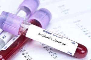 Нарушения секреции и действия антидиуретического гормона
