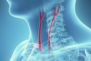 Окклюзионно-стенотические поражения магистральных брахиоцефальных артерий: фокус на модуляцию цереброваскулярного риска