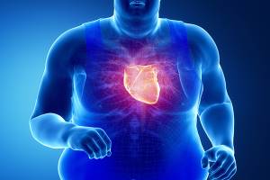 Проблема ожирения с позиций кардиологии