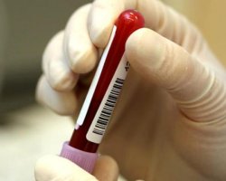 Антиретровирусная терапия и ее влияние на здоровье пациентов с ВИЧ