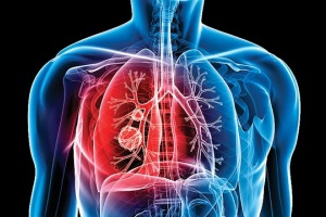 Затверджено нову державну програму боротьби з туберкульозом