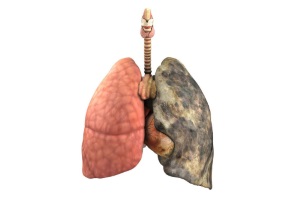 Клінічні протоколи надання медичної допомоги за спеціальністю «Пульмонологія»