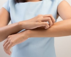 Контактный дерматит – болезнь «сверхчувствительной» кожи