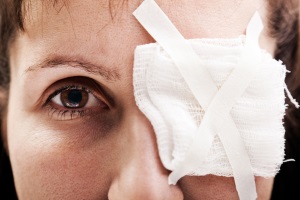 Рвана рана ока без випадіння чи втрати внутрішньоочної тканини