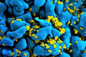 Про протидію поширенню хвороб, зумовлених вірусом імунодефіциту людини (ВІЛ), та правовий і соціальний захист людей, які живуть з ВІЛ