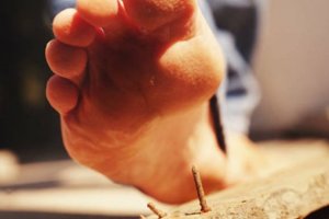 Профилактика столбняка