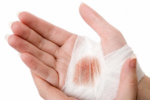 Раны: виды, первая помощь и профилактика шрамов
