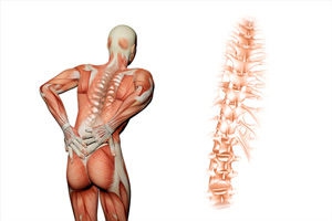 Лечение радикулита – как победить недуг?