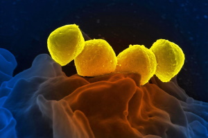 Отчет о результатах изучения роли, этиологии и устойчивости к антимикробным препаратам, включая гексеэтидин, клинических штаммов Streptococcus pyogenes