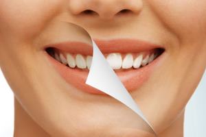 Насколько безопасно отбеливание зубов?