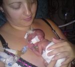 Любовь к жизни: новорожденная девочка, появившаяся на свет с весом 369 граммов, окрепла и отправилась домой