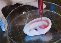 Медики сообщают о своих достижениях в «выращивании» органов для пересадки