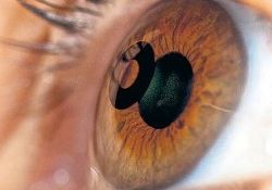 Прорыв в микрохирургии глаза: «старческой» дальнозоркости больше не будет
