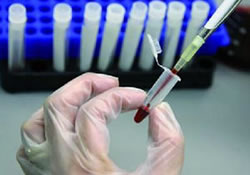 Луч надежды: начато испытание вакцины от СПИДа