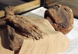 Рак предстательной железы – диагноз древнеегипетской мумии