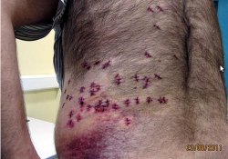Жизнь после 38 ударов ножом спасло ожирение