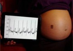 Удаленное наблюдение за состоянием беременных обеспечит «электронная татуировка»