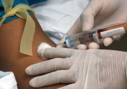 Прорыв в онкологии: обычный анализ крови заменит биопсию
