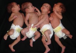 Рекорд: американка родила две пары идентичных близнецов за один раз