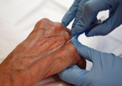 Открыт специфический иммуностимулирующий эффект противоопухолевых препаратов