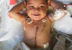 Пять новых органов спасли жизнь трехлетнего малыша