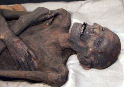 Коварство атеросклероза: мумии в борьбе против болезни