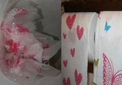 Неправильная туалетная бумага и кишечные кровотечения