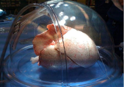 Трансплантация: испытания «спец-холодильника» начались