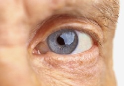 У некоторых мужчин прием виагры может ухудшить зрение