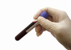 лихорадка Эбола