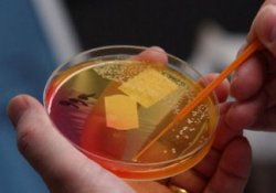 «Лекарства из земли»: почвенные бактерии выделяют суперантибиотик