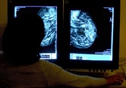 Ученые разрабатывают метод диагностики 4-х видов «женского рака»