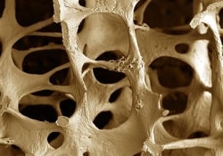 Частые беременности чреваты остеопорозом