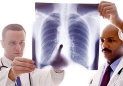 ВОЗ считает высокий уровень смертности от туберкулеза неприемлемым явлением