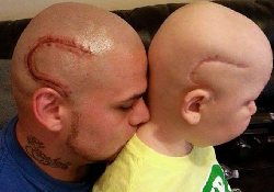 Отец морально поддержал тяжелобольного сына с помощью необычной татуировки