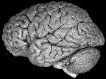 Прибор глубокой стимуляции мозга: лечение болезни Паркинсона