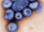 В смертях от свиного гриппа часто замешаны сопровождающие инфекции