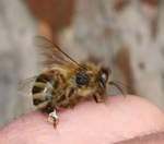 Полторы тысячи пчелиных укусов поставили на ноги больную рассеянным склерозом