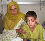 Индийский мальчик прожил два года с огромной щепкой в глазу