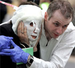 Британские хирурги сделали новое лицо знаменитой жертве лондонских терактов
