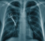 Ошибки американских врачей обходятся в 55 миллиардов долларов ежегодно