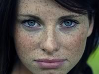 Веснушки - проявление наследственной особенности пигментации кожи Веснушки - проявление наследственной особенности пигментации кожи