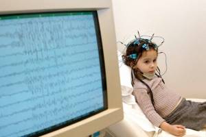 Современные препараты в терапии эпилепсии у детей