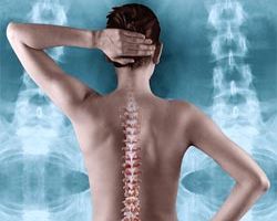 Климакс и остеопороз – как не споткнуться на ступеньке