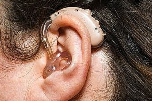 Цифровые программируемые слуховые аппараты «Отикон»