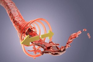 Телемост по вопросам артериальной гипертензии — первый проект завершился успехом (укр)