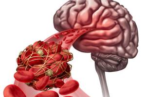 Нарушения метаболизма при сосудистых заболеваниях головного мозга