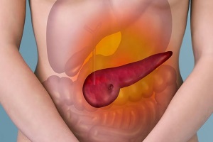 Хронический панкреатит в сочетании с сахарным диабетом – как выстоять поджелудочной железе?
